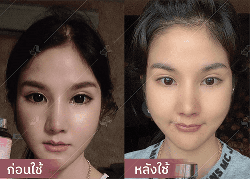 รีวิว HORSY ผมร่วง ผมบาง รอยแสกกว้าง - 8