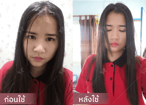รีวิว HORSY ผมร่วง ผมบาง รอยแสกกว้าง - 7