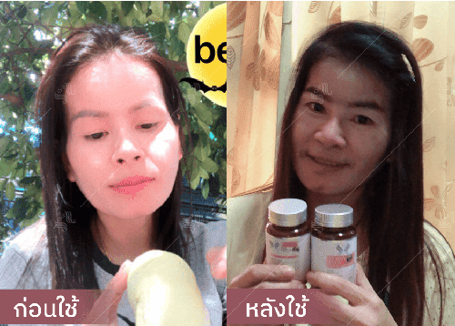 รีวิว HORSY ผมร่วง ผมบาง รอยแสกกว้าง - 9