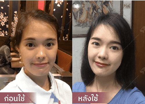 รีวิว HORSY ผมร่วง ผมบาง รอยแสกกว้าง - 8