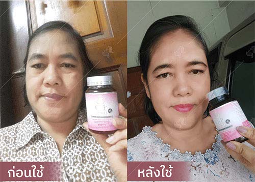 horsy_before-after001