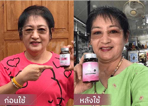 horsy_before-after002