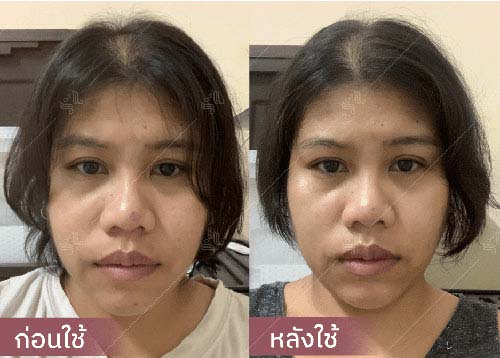 horsy_before-after003