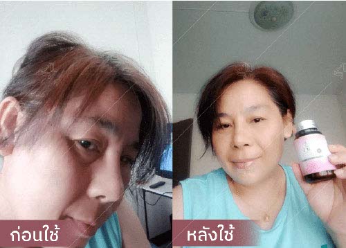 horsy_before-after004