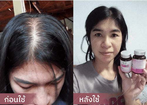 horsy_before-after005