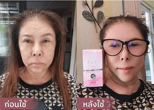 horsy_before-after006