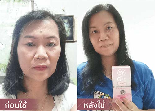 horsy_before-after007