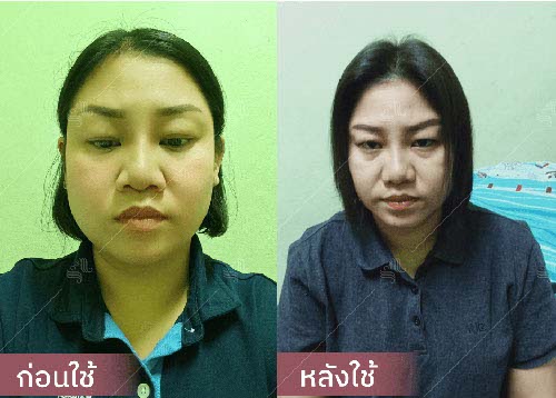 horsy_before-after010