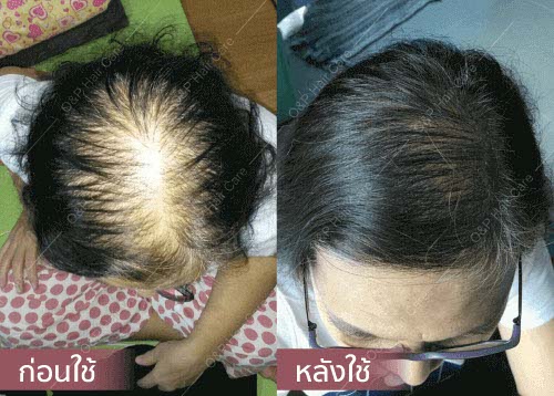 horsy_before-after012