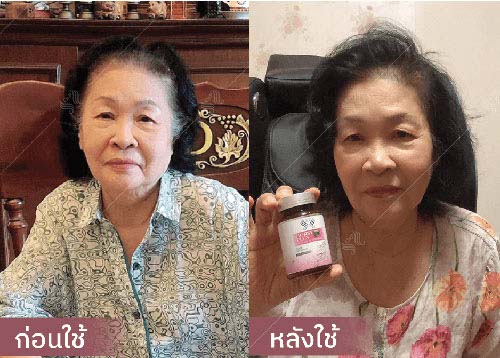 horsy_before-after013