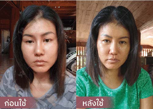 horsy_before-after014