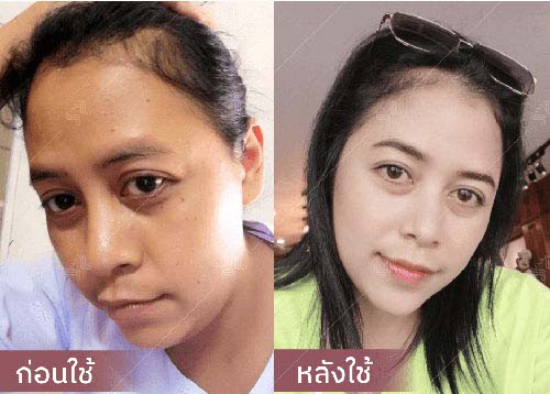 horsy_before-after015