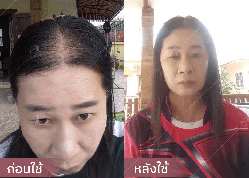 horsy_before-after017