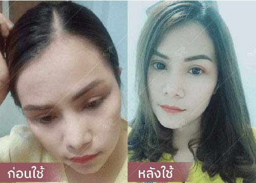 horsy_before-after021