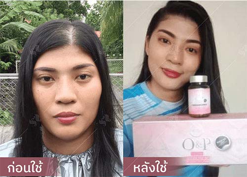 horsy_before-after043