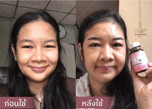 horsy_before-after044