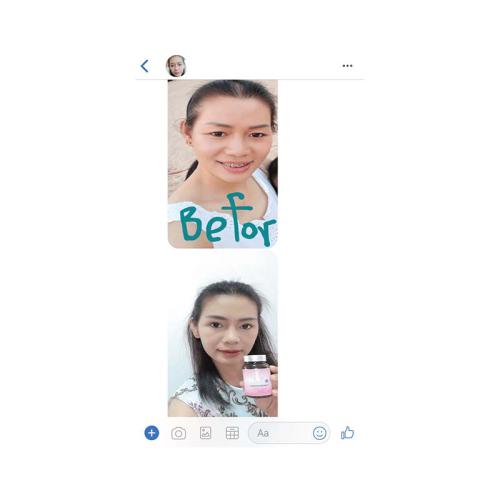 horsy_แคปแชท005